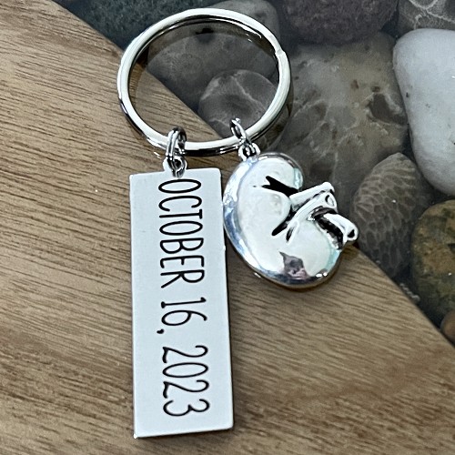  Personalized Kidney Transplant Keychain - Donor/Recipient - Customizable Back 